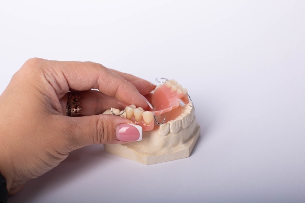The Longevity Of Dental Bridges: What You Should Know